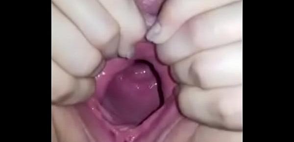  Wide open pussy low cervix